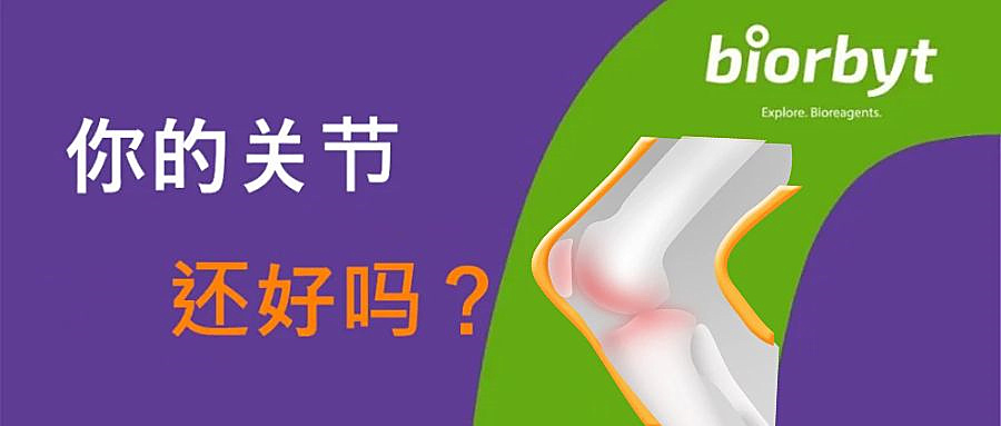 【Biorbyt科研专题】关节炎与血管生成