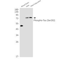 Anti-Tau (phospho S202)