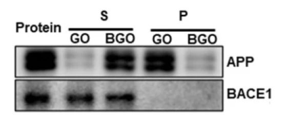 解锁阿尔茨海默病（AD）靶点密码，开启靶向治疗新篇章