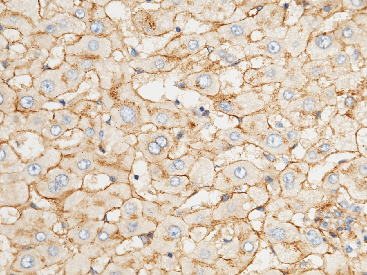 解锁阿尔茨海默病（AD）靶点密码，开启靶向治疗新篇章