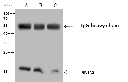 Anti-alpha-Synuclein Antibody, Rabbit Polyclonal