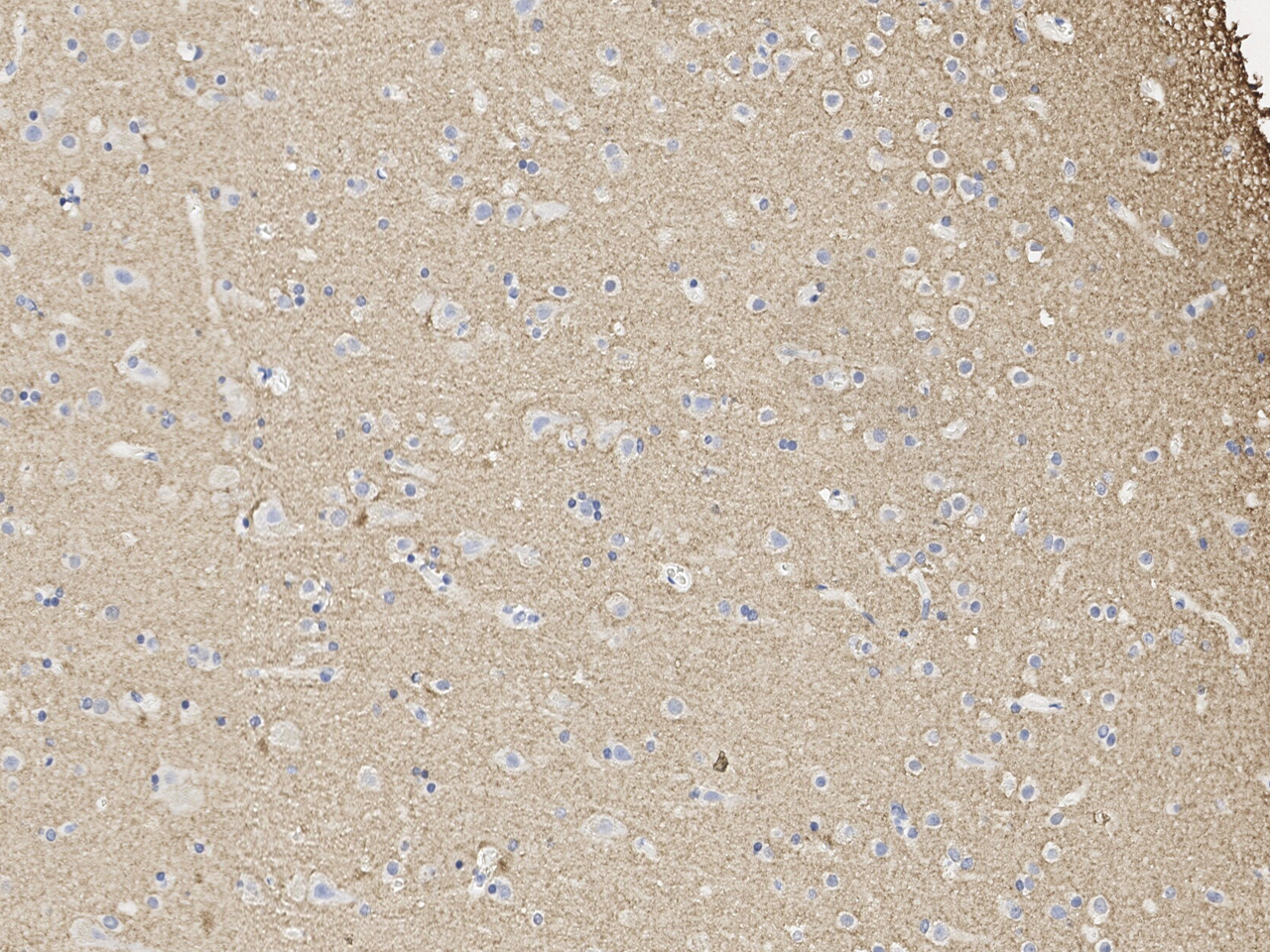 Anti-alpha-Synuclein Antibody, Rabbit Polyclonal