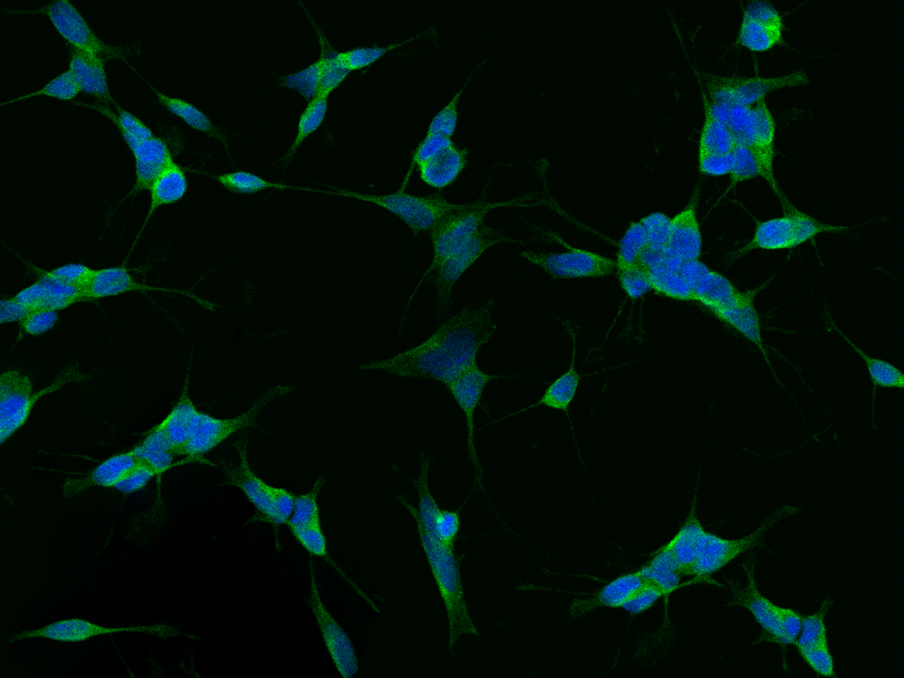 Anti-alpha-Synuclein Antibody, Rabbit Polyclonal