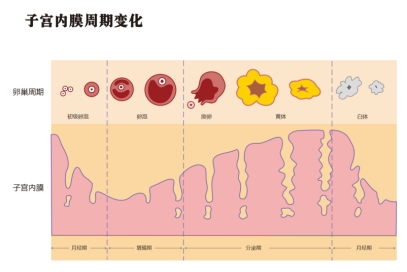 小心子宫内膜跑偏了，这些原因导致内异症！