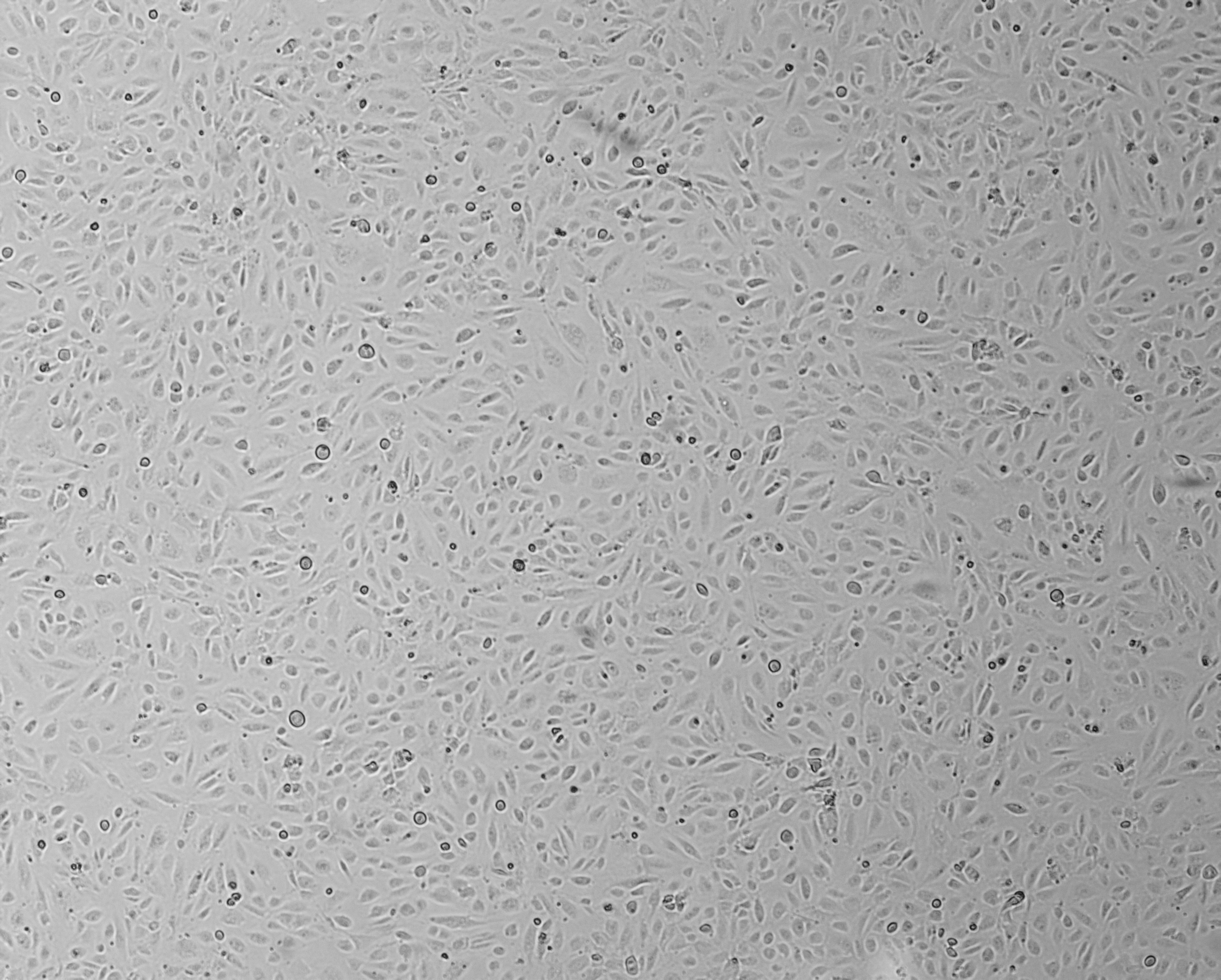 细胞攻略 | HUVEC-SV40(人脐静脉内皮细胞永生化)细胞培养教程