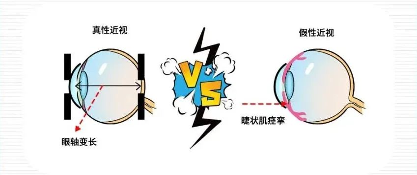 怀疑孩子近视？别「真假」傻傻分不清