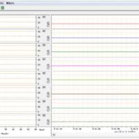 疼痛自动分析系统