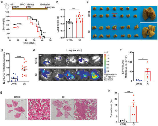 IF>39 |乳腺癌肺转移“凶手”——MHCIIhi中性粒细胞