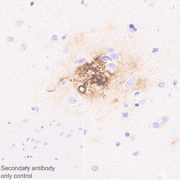 Anti-beta Amyloid 1-40[EPR2371