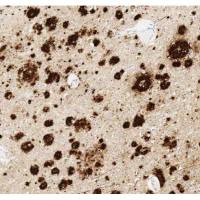 Anti-Amyloid Fibril[mOC22] - Conformation-Specific