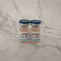 抗伤寒杆菌O血清