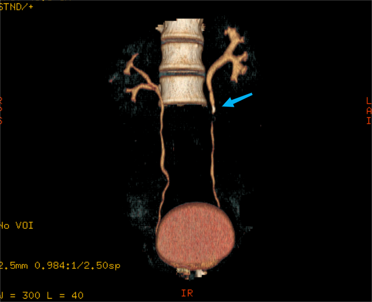 这种痛千万别错当扭伤！趁没严重来个「冲击波」就好