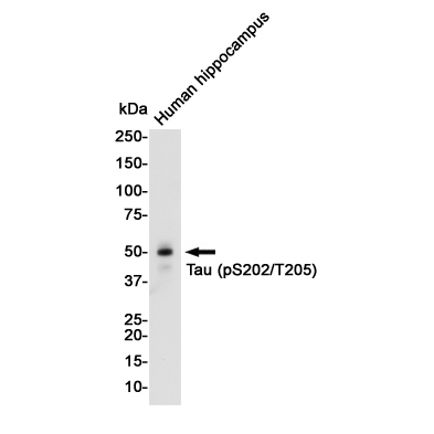 Anti-Tau (phospho S202 + T205)
