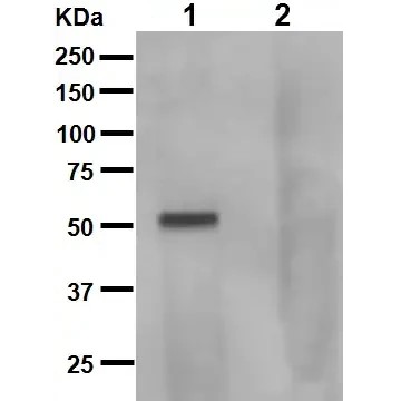 Anti-Tau (phospho S262 + T263)
