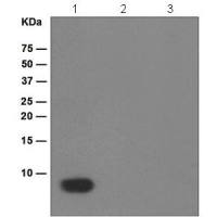 Anti-beta Amyloid 1-38[EPR1878(2)]