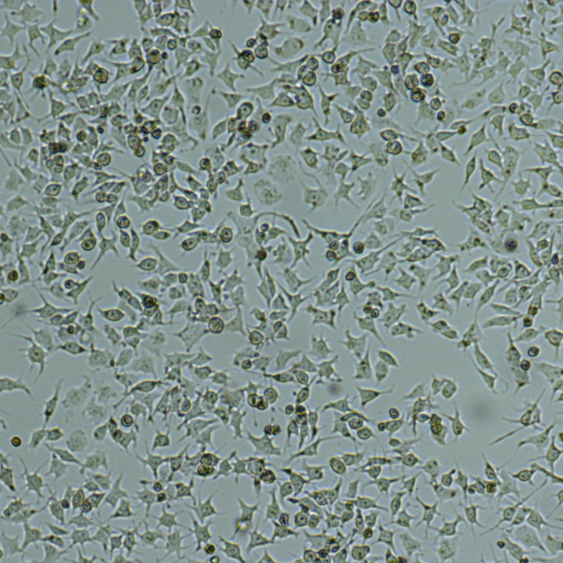 92-1[92-1]人葡萄膜黑色素瘤细胞