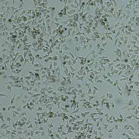 92-1[92-1]人葡萄膜黑色素瘤细胞