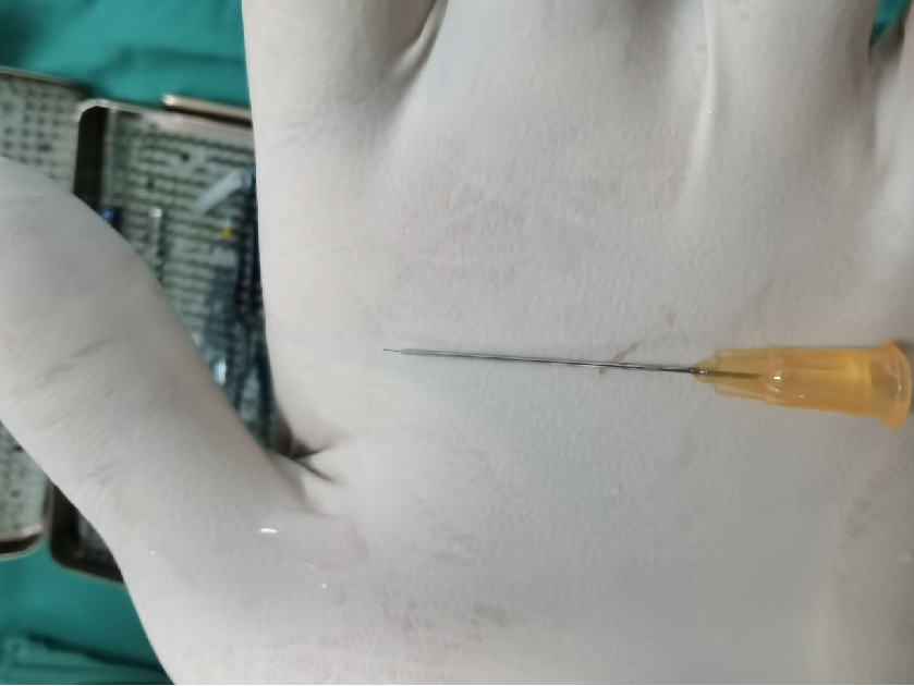 不断拓展眼底病领域「视」野,「医」心守护患者光明——柳州市红十字会医院眼底病与白内障专科篇