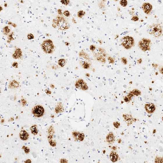 Anti-Amyloid Fibril[mOC78] - C