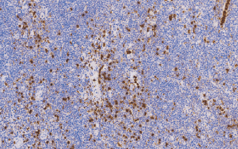 兔抗人溶菌酶多克隆抗体