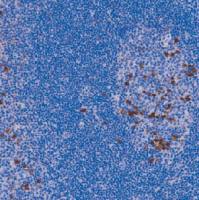 兔抗人免疫球蛋白G多克隆抗体