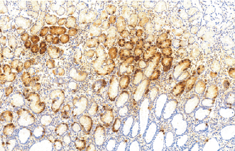 兔抗人胃泌素多克隆抗体