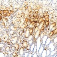 兔抗人胃泌素多克隆抗体