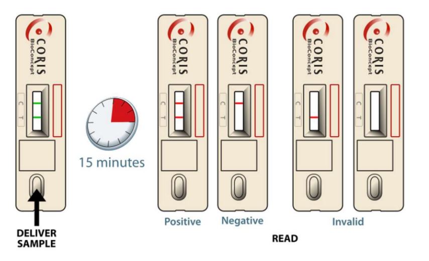 碳青霉烯酶胶体金检测盒