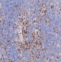 兔抗人溶菌酶多克隆抗体