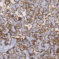 兔抗人绒毛膜促性腺激素多克隆抗体