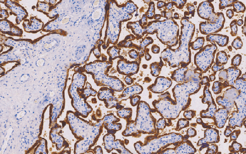 兔抗人胎盘催乳素多克隆抗体