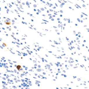 兔抗人2型单纯疱疹病毒多克隆抗体