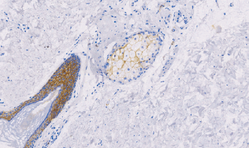 兔抗人Claudin1多克隆抗体