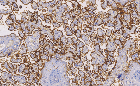 兔抗人绒毛膜促性腺激素(β)多克隆抗体