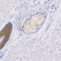 兔抗人Claudin1多克隆抗体