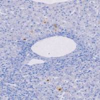 兔抗人HBCAg多克隆抗体