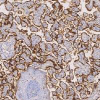 兔抗人绒毛膜促性腺激素（β）多克隆抗体