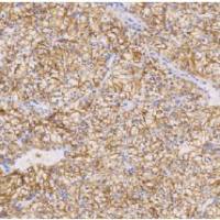 兔抗人钙视网膜蛋白多克隆抗体