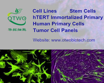 HGMC人肾小球系膜细胞|永生化人肾小球系膜细胞|HGMC细