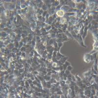 NCI-H295R [h295r;nci h295r;ncih295r]人肾上腺皮质腺癌细胞