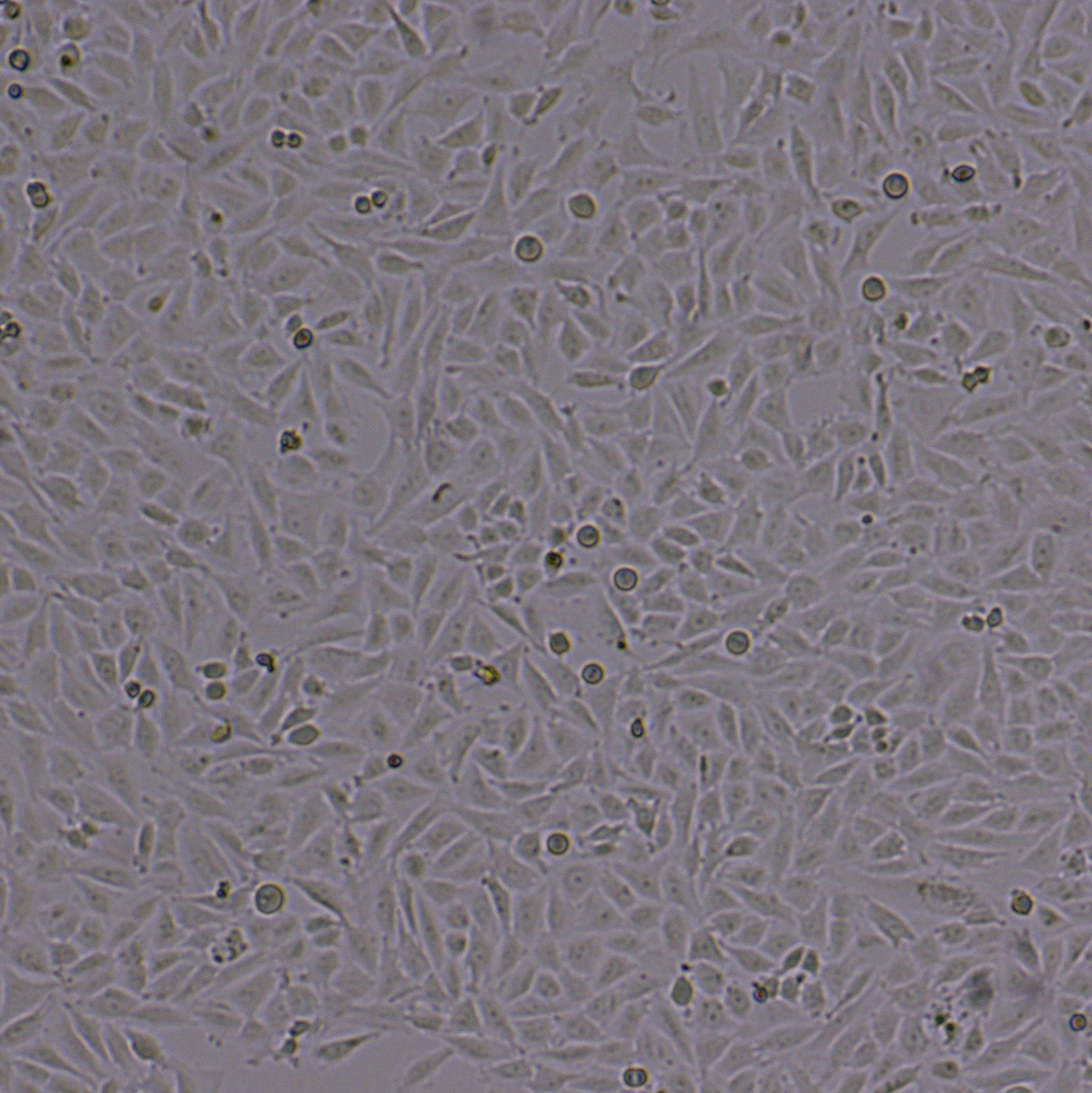 LN18[LN18;LN-18;LN 18]人胶质母细胞瘤细胞