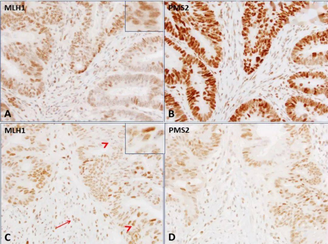 结直肠癌造模方法