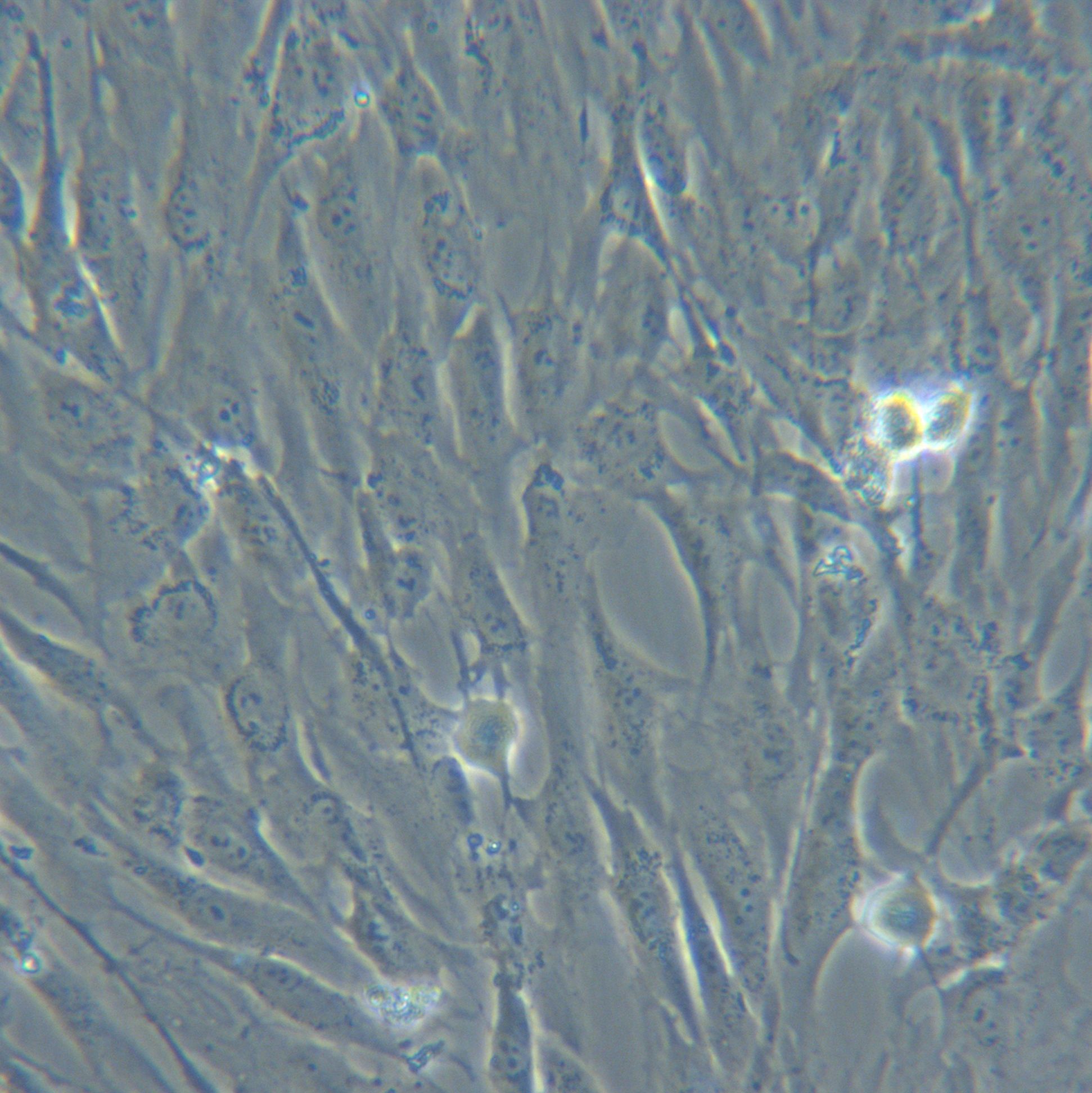 HMSC-ad永生化人脂肪间充质干细胞