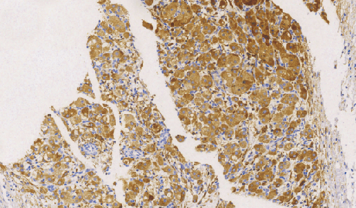 鼠抗人组织蛋白酶-K单克隆抗体 TDCCM-0290