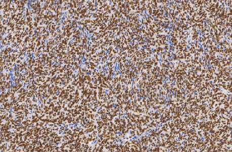 鼠抗人ATRX 单克隆抗体 TDCAM-0250