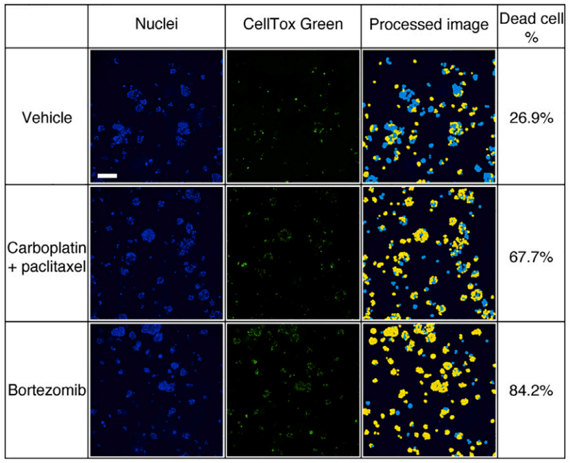 类器官达人 | 让卵巢癌类器官培养变得更简单