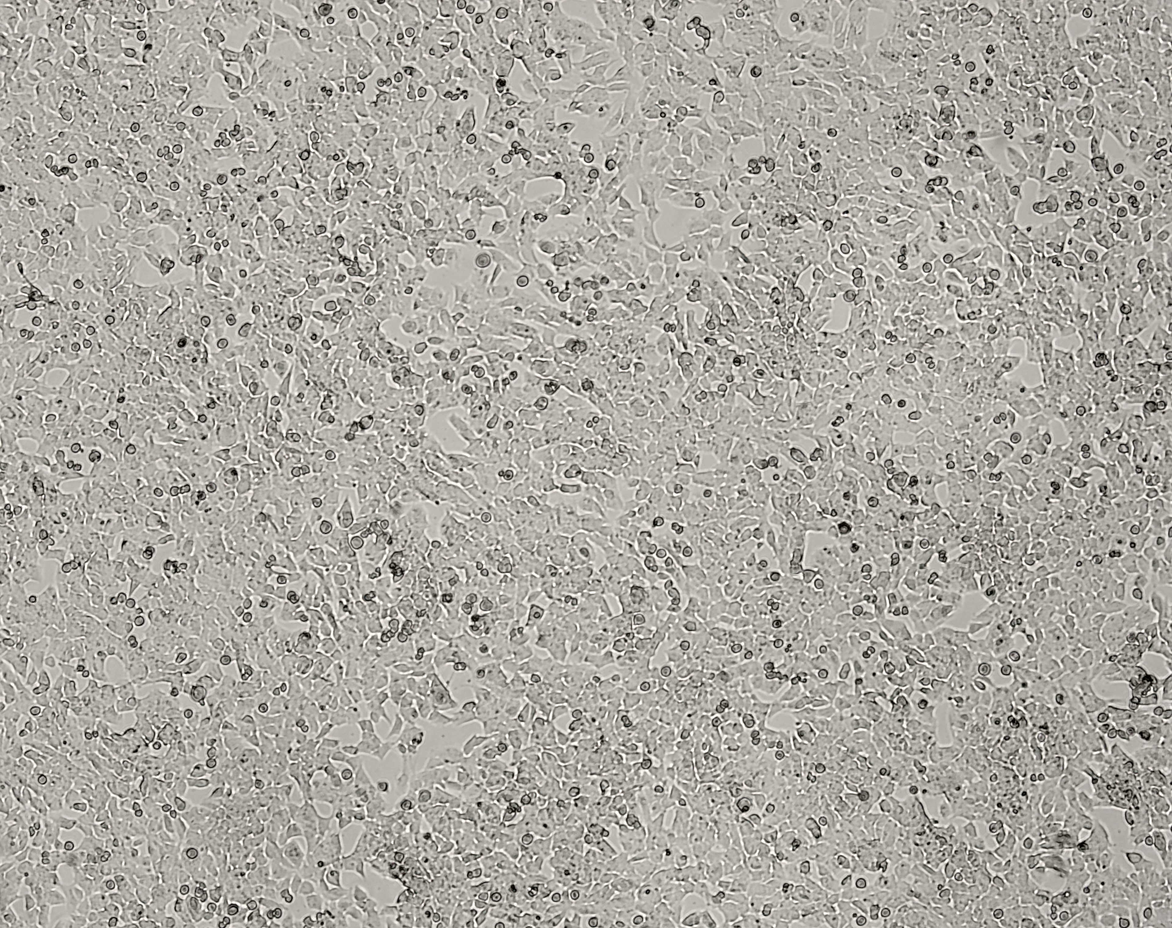 细胞攻略 | GL261(小鼠胶质瘤细胞)培养教程