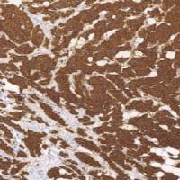 鼠抗人CA15-3单克隆抗体 TDCCM-0160