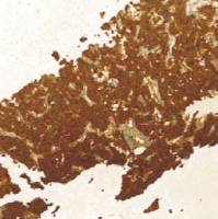 兔抗人降钙素多克隆抗体  TDCCR-0190