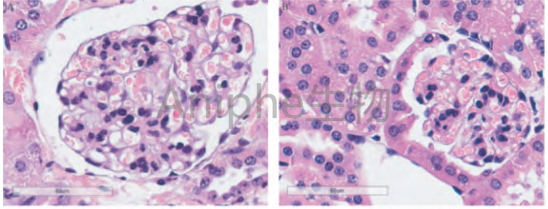 疾病模型|一文了解2型糖尿病(T2DM)动物模型的常用造模方法!